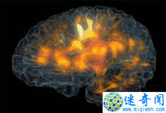 �������۲���Ի ȫ�µ����鲡�˵ĸ���