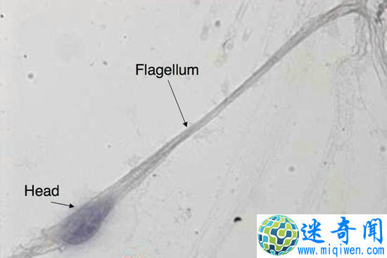 ľ(ͼƬ: M-H Perrard,CNRS/Kallistem)