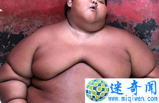 10岁胖娃成世界最重男孩 除了吃饭就是睡(3)