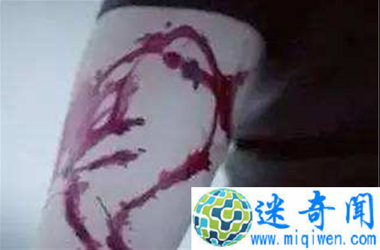 蓝鲸游戏50指令诱人自残自杀 粉鲸游戏能否拯救?