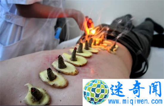 盘点奇葩的重口味养生 尿疗卧轨电疗长见识