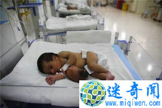 ӡȺ˫ͷŮӤ ڶͷڶƤ