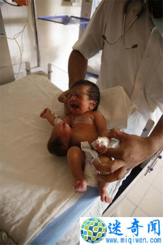 ӡȺ˫ͷŮӤ ڶͷڶƤ