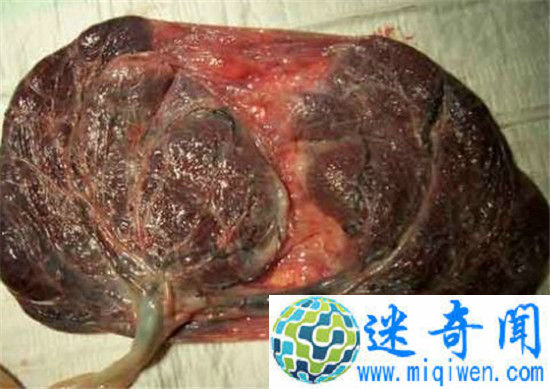 ̥̺аôĿ ˽ӹĲȡ귨ɿӣ